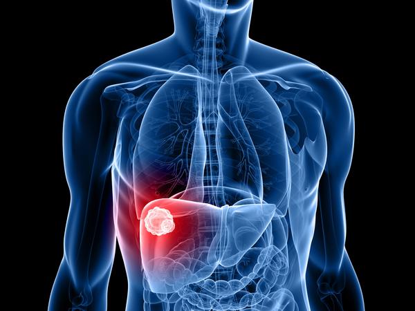 faktori rizika za tumor jetre