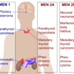 men