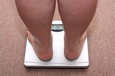 Gojaznost povecava rizik od karcinoma