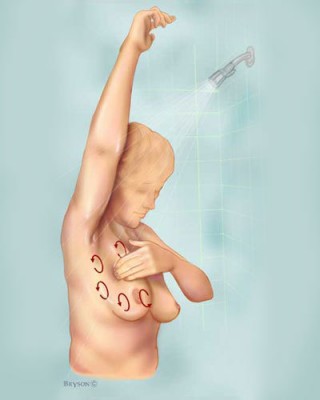 samopregled-dojke-4